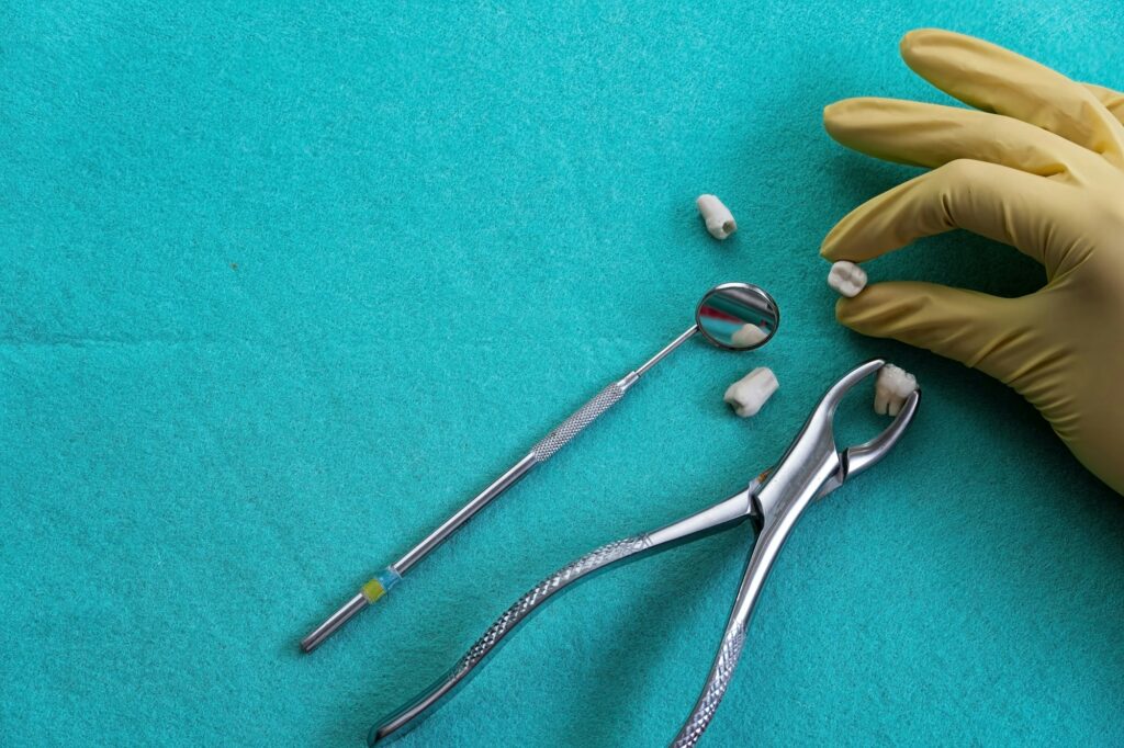 Closeup of a tooth extraction with forceps on a blue surface