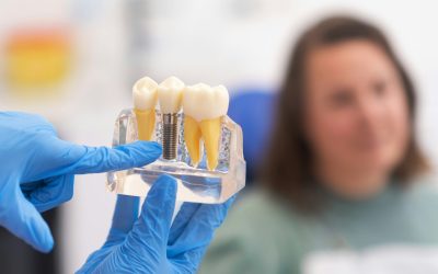 dental implants, dentist discussing a treatment plan with patient holds a dental implant model