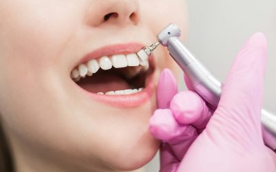 Dentist brushes teeth young girl. Teeth whitening procedure