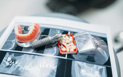 Dentures and pins on the table, dental prostheses